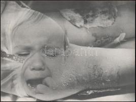 cca 1979 Mórocz István: Fájdalom, feliratozott, vintage fotóművészeti alkotás, kasírozva, 28,7x38,5 cm