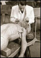 Orvosi boncolást bemutató negatívok, 11 kocka tekercsben