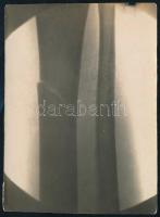 1928 Törött lábról készült felvétel, fotó, 9,5×12,5 cm