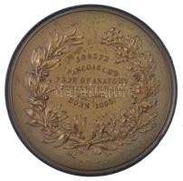 Amerikai Egyesült Államok 1870. "Joseph Pancoast M. D. - Az anatómia professzora - Jefferson Or...