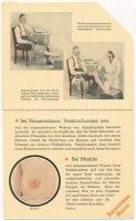 1933 Die Physiologische Behandlung Oberflächlicher und Tiefsitzender Entzündungs-Prozesse / Felülete...