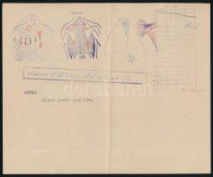 1942 Bp., Horthy Miklós máv. kórház és központi rendelő lelete egy pozitív tüdőbetegről