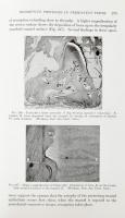 Kronfeld, Rudolf: Histopathology of the Teeth and Their Surrounding Structures. Philadelphia, 1943, ...