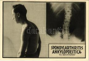 1932 Pöstyén, Piestany; Spondylarthritis Ankylopoeitica M. Bechterev. Pro Patria fürdő népszanatórium orvosi gyakorlatából, Gamma-Kompressz reklámlap / spas advertisement, mud treatment (18,5 cm x 10,5 cm)