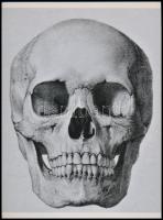 Koponyák, az aktkompozíció eredetileg olajfestmény, a másik felvétel orvosi könyv illusztrációja, 2 ...