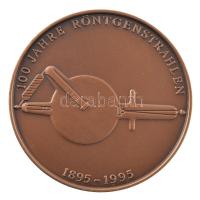 Németország 1995. "100 éves a röntgen" kétoldalas bronz emlékérem (40mm) T:1-
Germany 199...
