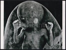 cca 1965 Magzat az anyaméhben, orvosi felvétel, 1 db modern nagyítás, 17,7x23,8 cm