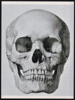 Koponyák, az aktkompozíció eredetileg olajfestmény, a másik felvétel orvosi könyv illusztrációja, 2 ...