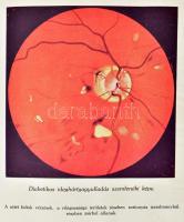 Dr. Bálint Rezső et al.: A cukorbetegség és az insulin. Bp., [1927], Dick Manó (Hornyánszky-ny.), 30...