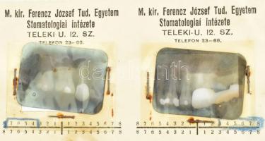 1938 Bp., M. kir. Ferencz József Tud. Egyetem Stomatológiai Intézete, 4 db röntgenfelvétel (fogröntg...