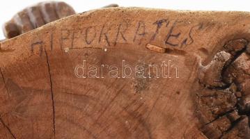 Csorvássy István (1912-1986): Hippokratész. Jelzéssel, kopással, m: 52 cm