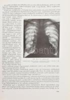 Zsebők Zoltán: A radiológia alapvonalai. Bp., 1969., Medicina. Második kiadás. Kiadói nyl-kötés. Meg...