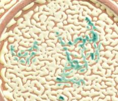 B. Várdeák Ildikó (1929-2013): Mázas kerámia kínáló és váza, jelzett, vázán kopással, d 22 cm, m: 16...