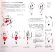 Lampé László - Papp Zoltán: Szülészet-nőgyógyászat. 1-2. köt. Bp., 1992, Semmelweis Kiadó. Kiadói ka...