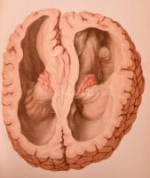 Bollinger O[ttó]: A kórboncztan alapvonalai. Atlaszszal. [A kórboncztan atlasza.] I-II. köt. Ford.: ...