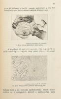 Dr. Okolicsányi-Kuthy Dezső: A gümőkor. A nagy nép-betegség természetének, jelentőségének és az elle...