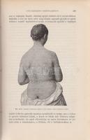 Róna Sámuel: 
A buja vagy nemi betegségek. Egyetemi előadásai fonalán orvosoknak és orvostanhallgat...