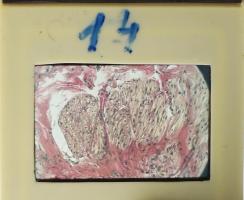 2 doboz dia laboratóriumi eredményekről, kb. 170 db