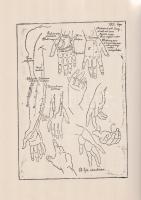 (Anonim művészeti anatómiai jegyzet illusztrált, géppel írt kézirata, Székely Bertalan 1888. évi ,,F...