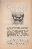 Morton, J., Edin, L. D. S.
Műfogsorok helyes felállítása. A magyar kiadást átnézte és előszóval ell...