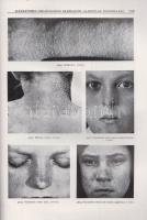 Nékám Lajos (szerk.)
Corpus Iconum Morborum Cutaneorum. Auxilio 568 collaboratorum specialiter erud...