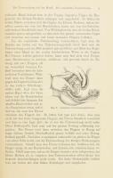 Schroeder, Carl: Handbuch der Krankheiten der weiblichen Geschlechtsorgane. Leipzig, 1898, F. C. Vog...