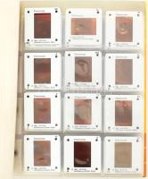 Stefan Seidl: Colposcopy. Colposcopical Findings in the Portio, the Vagina and the Vulva. Hamburg, 1...