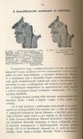 Sulyomi-Schulmann Adolf: A farkastorok okozta beszédzavar és javításának módja. Bp., 1936, Magyar Gy...