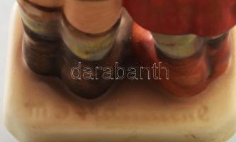 Hummel "Surprise" figura, jelzett, restaurált, m: 14,5 cm