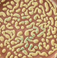 Gál Béla: Zsugormázas kínáló. Jelzett, hibátlan, 21x19 cm