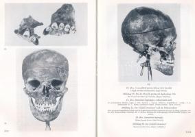 Semmelweis betegsége. (Die Krankheit von Semmelweis). Szerk.: Dr. Hüttl Tivadar. Dr. Zoltán Imre elő...