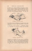 Platen, M[oritz]: 
Az új gyógymód. A természetszerű életmódnak, az egészség ápolásának és a gyógysz...