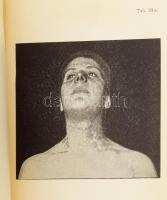 Mracek, Franz: A syphilis és a venereás betegségek atlasza. Pathologiájuk és therapiájuk alapvonalai...