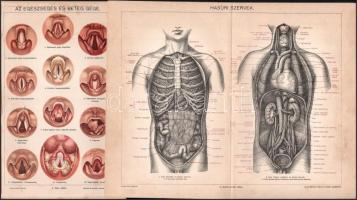 cca 1900 5 db emberi testtel, betegségekkel kapcsolatos melléklet a Pallas Nagy Lexikonából. Javarészt színes litográfiák. 24x30 cm és 15x24 cm