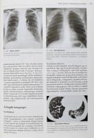 Radiológia. Szerk.: Fráter Loránd. Bp., 2010., Medicina. 3. kiadás. Gazdag képanyaggal illusztrált. ...