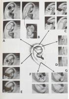 Zoltán János: Cicatrix Optima. Az ideális sebgyógyulás műtéttana. Bp., 1974, Medicina - Akadémia. Ki...