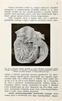 Buday Kálmán - Veszprémi Dezső: Kórboncolástan. II. részletes rész. 224 eredeti ábrával. Bp., 1915, ...