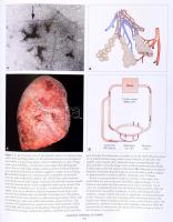 James D. Crapo (szerk.): Atlas of chronic osbstructive pulmonary disease. Philadelphia, 2009, Curren...