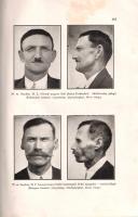 Doros Gábor:  A magyarság életereje. A nemzettest biológiája, fajegészsége és eugéniája. Budapest, 1944. Turul Szövetség Könyv- és Lapterjesztő Kft. (Athenaeum ny.) 646 p. Első kiadás. Oldalszámozáson belül 114 egész oldalas képpel, térképpel, rajzzal illusztrált. Doros Gábor (1892-1980) orvos, bőrgyógyász, egyetemi tanár fajbiológiai munkájában számos fejezetet szentel az emberiség nagyrasszainak jellemzésére, a nagyrasszokon belül pedig különös figyelmet szán a magyarság szempontjából meghatározó jellegű turanid és ugor rassztípus antropológiai és jellemtani meghatározására, majd kidolgozza a magyarság és a hazai nemzetiségek együttélésének történetét. Az utolsó fejezetek fajhigiénés programja a magyarság megerősítését a korai házasodásban, az egykézés visszaszorításában, a családtámogatási és társadalombiztosítási programok kidolgozásában látja. A fajhigiénés terminológiájú antropológiai munka rákerült az Ideiglenes Nemzeti Kormány által 1945-ben betiltott művek jegyzékére. Az előzékeken és a belív néhány oldalán apró rozsdafoltosság. (Turul könyvek.) Aranyozott, enyhén sérült gerincű kiadói félvászon kötésben. Jó példány.