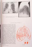 Ifj. Kováts Ferenc - Zsebők Zoltán: A tüdő röntgenanatómiája. Bp., 1959, Akadémiai Kiadó. Kissé faku...