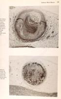Essantial Pathology. Edited by Emanuel Rubin, John L. Farber. Philadelphia,1990,J.B. Lippincott Co.,...