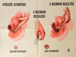 cca 1950-60 Pessarium bevezetése, egészségügyi felvilágosító plakát, ofszet, papír, Matkó B. Szeged jelzéssel, Nyomdakísérleti, hajtva, apró lapszéli szakadásokkal, 59,5x84 cm