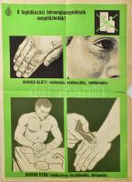 1967 A Foglalkozási bőrmegbetegedések megelőzhetők! Egészségügyi felvilágosító plakát, papír, Offset-nyomda, hajtva, lapszéli sérülésekkel, elszíneződésekkel, 69,5x49,5 cm