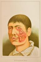 Julius Hochnenegg: Jahresbericht der ersten Chirurgischen Klinik des Hofrathes Pressor Albert in Wie...