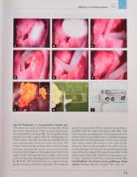 Szalay-Ungár: Cervical Pathology. Colposcopy and Cytology. Győr, 2007, Cytosza Publishing. Kiadói ka...