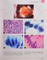 Szalay-Ungár: Cervical Pathology. Colposcopy and Cytology. Győr, 2007, Cytosza Publishing. Kiadói ka...