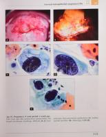 Szalay-Ungár: Cervical Pathology. Colposcopy and Cytology. Győr, 2007, Cytosza Publishing. Kiadói ka...