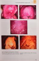 Szalay-Ungár: Cervical Pathology. Colposcopy and Cytology. Győr, 2007, Cytosza Publishing. Kiadói ka...