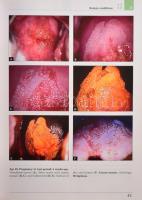 Szalay-Ungár: Cervical Pathology. Colposcopy and Cytology. Győr, 2007, Cytosza Publishing. Kiadói ka...