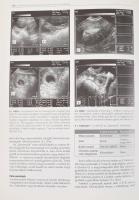 Tóth Zoltán - Papp Zoltán (szerk.): Szülészet-nőgyógyászati ultrahang-diagnosztika. Bp., 2001, White...